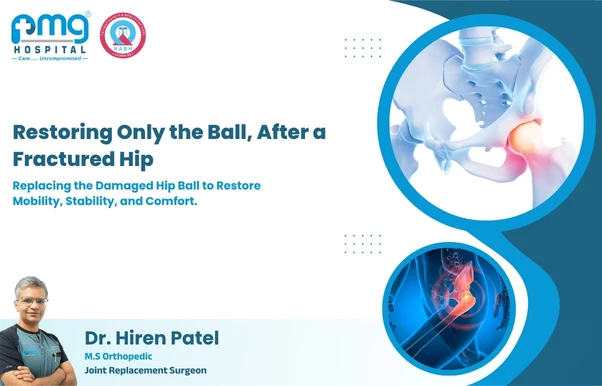 Partial Hip Replacement (Hemiarthroplasty) at PMG Hospital, Gota, Ahmedabad