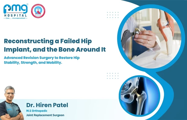 Revision Hip Replacement at PMG Hospital, Gota, Ahmedabad
