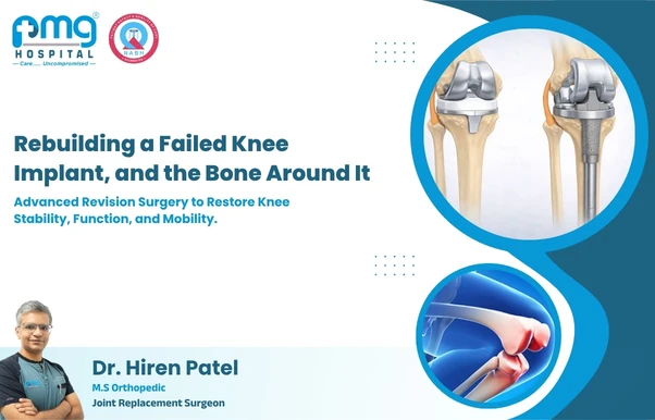 Revision Knee Replacement at PMG Hospital, Gota, Ahmedabad
