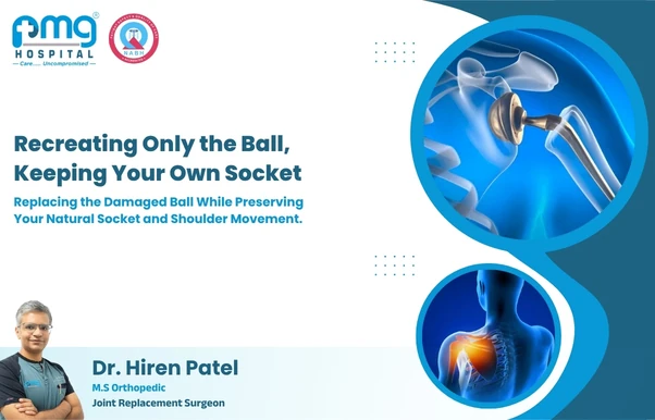 Partial Shoulder Replacement (Hemiarthroplasty) at PMG Hospital, Gota, Ahmedabad
